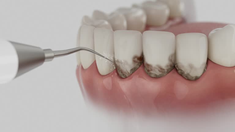 Reliable Root Canal Treatment contractor in Transylvania County County, NC by Dentist Open Now